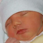 Vì sao trẻ có hiện tượng vàng da?