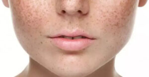 Tử cung thay đổi sau sinh